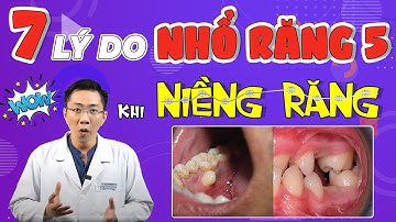 Nhổ Răng 5 Hay Răng 4? 7 Lý Do Nên Nhổ Răng 5 Khi Niềng Răng