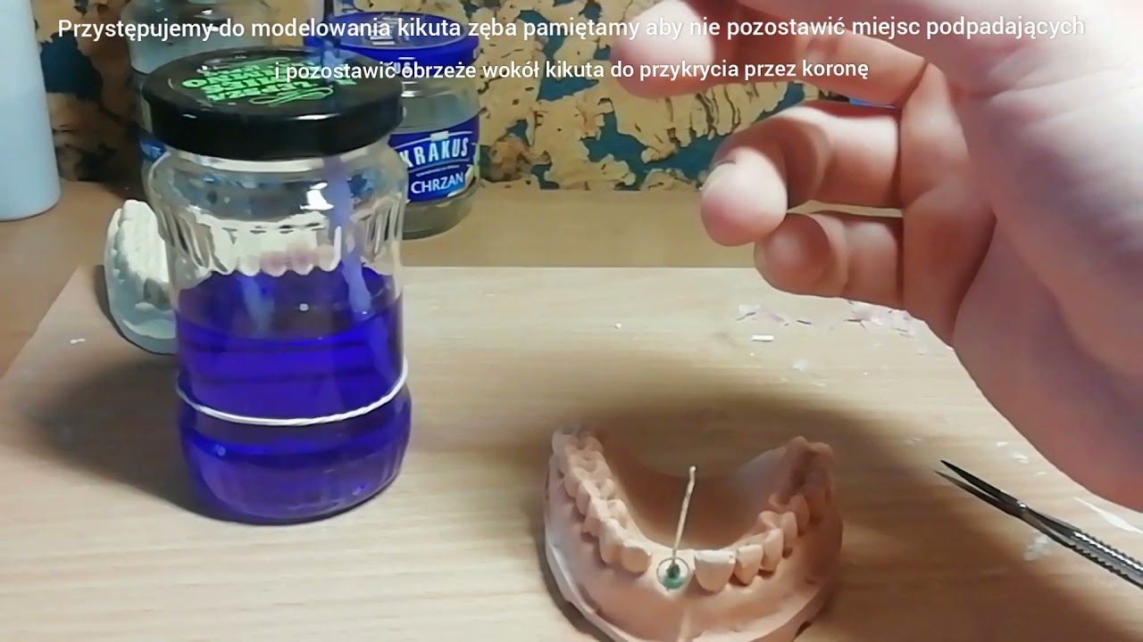 Technik dentystyczny - wykonanie wkładu koronowo korzeniowego w wosku
