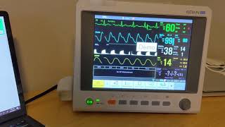 AnesthesiaCharting.com - Auto Monitoring Walkthrough