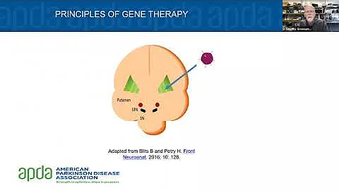 Dr. Gilbert Hosts: Gene Therapy and Parkinson's Di...