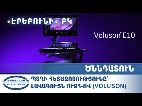 Video: Ո՞վ Պորտուգալիայի առողջապահական համակարգը: