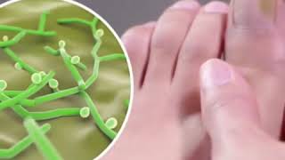 ANTI FUNGUS BIOLOGICAL NAIL REPAIR PENCIL  ( Unique Age )