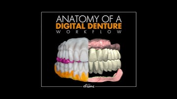Anatomy of a Digital Denture Workflow - Teaser