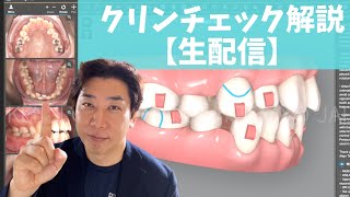 クリンチェック解説【生配信】小臼歯4本抜歯オープンバイトアライナー矯正治療