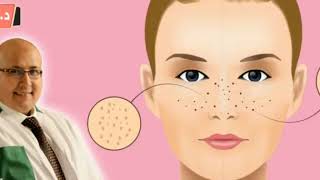 وصفات لعلاج مشاكل البشرة  الحبوب في الوجه , البقع السوداء ,الجاف , التجاعيد من الدكتور عماد ميزاب