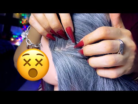 INSANE DANDRUFF Removal😴👀, ASMR Dandruff Scratching, 2ver(Inaudible whisper & no talking)