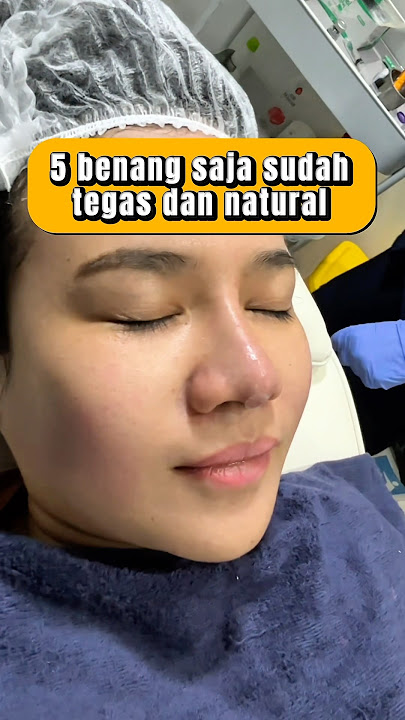 Tanam benang benarkah harus banyak ? #tanambenang #threadlift #dokterkecantikan