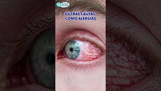 Eyes Give Signs Of Disease