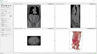 Famous ScanXm tutorial - Image processing Profile