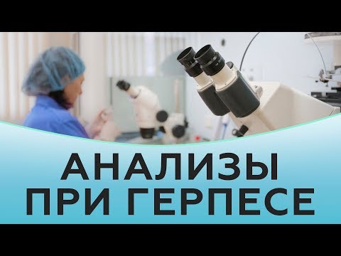 Какие анализы сдают при герпесе