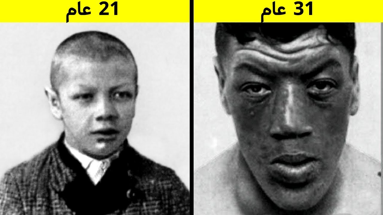 كان هذا الرجل في الماضي قزم وعملاق