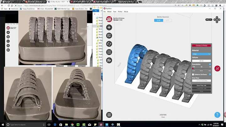 Ortho Aligner Model Printing: RayWare vs. Preform