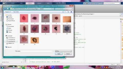 Melanoma Classification on Dermoscopy Images using a Neural Network Ensemble Model