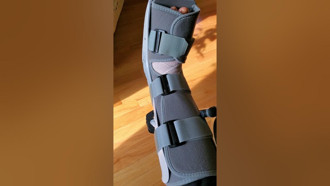 Lapiplasty (bunion surgery) exercising after surgery YouTube