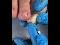 Gentle Pedicure Care | Clean Toenail Trim #fypシ #cleannails #satisfying