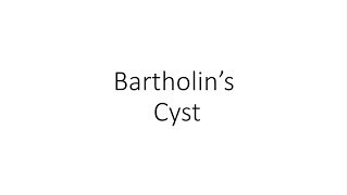 Bartholin's Cyst - Gynecology Bartholin's Cyst - Gynecology