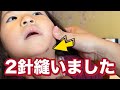 緊急で病院へ たねちゃん2針縫いました 緊急で病院へ たねちゃん2針縫いました
