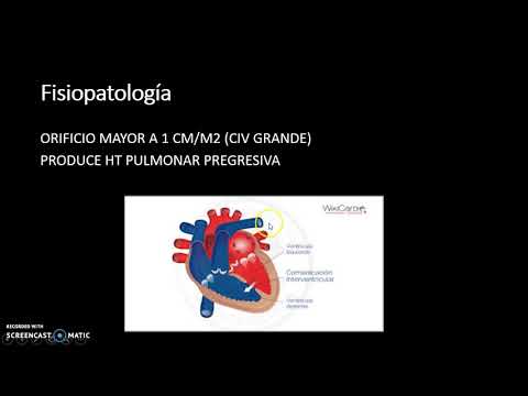 Vídeo: Un Caso De Miocardiopatía Hipertrófica Combinada Con Comunicación Interventricular Muscular Y Origen Anormal De La Arteria Coronaria Derecha