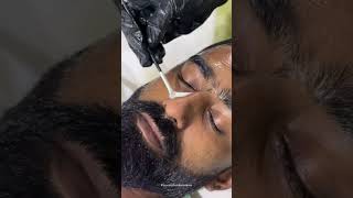 Ayraa Clinic10% Vinter Offer Ayra Clinic Rejuvenation Clinicambalathin Kara No 91 95674 87707