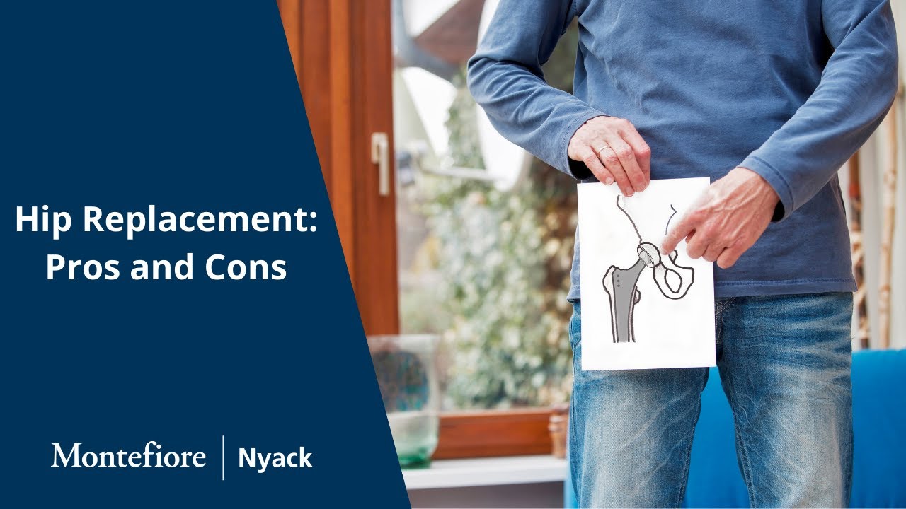 Hip Replacement Surgery Pros and Cons YouTube
