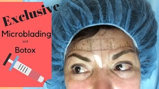 Exclusive!  Come with me while I get microblading, permanent lip makeup and Botox.