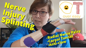 Splints (Part 2)- Peripheral Nerve Injuries