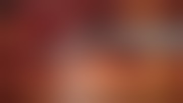 Extended Right Colectomy with Complete Mesocolic Excision | ASCRS Annual Meeting