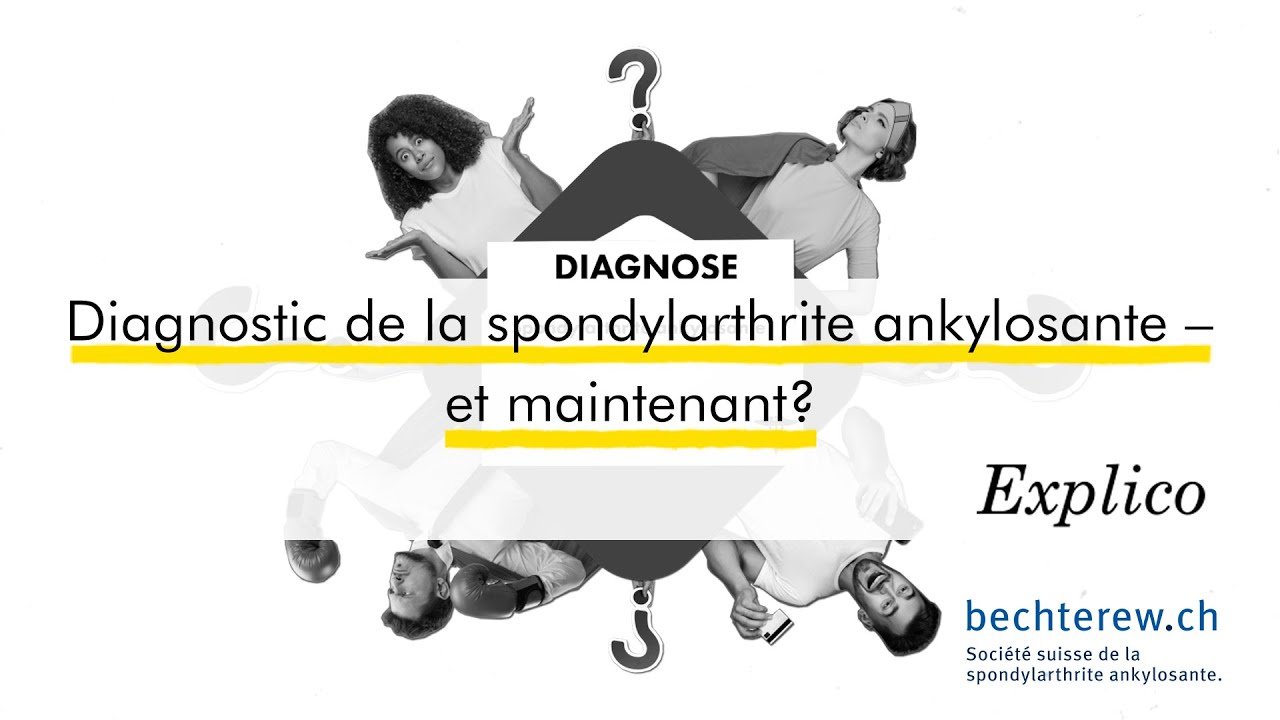Diagnostic de la spondylarthrite ankylosante – et maintenant?