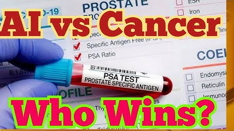 How AI is Changing Prostate Cancer Treatment: Smarter Decisions for Doctors#ProstateCancer  