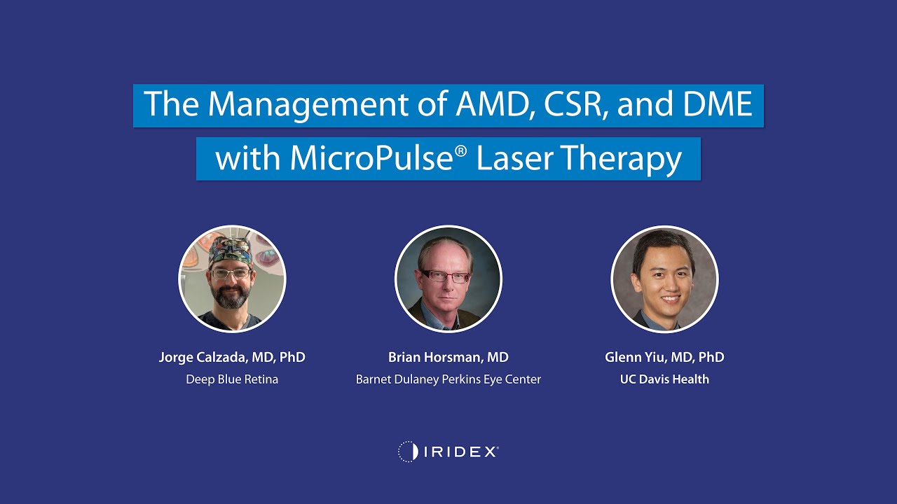 The Management of AMD, CSR, and DME with MicroPulse Laser Therapy YouTube