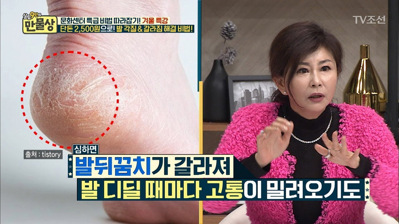 겨울철, 건조한 발뒤꿈치를 잡아줄 뷰티강사의 꿀팁! [만물상 228회] 20180118