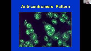 Anti-Nuclear Antibodies