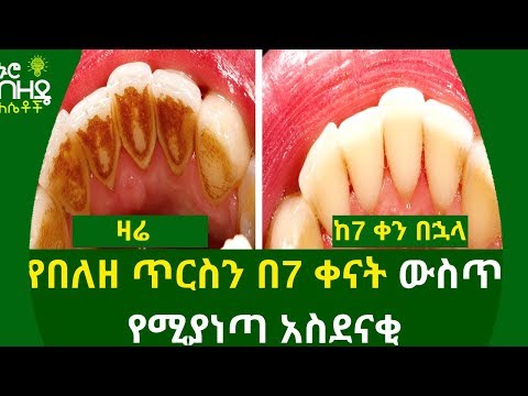 ቪዲዮ: ውሾች ውስጥ ጥርስ የተሳሳተ አቀማመጥ