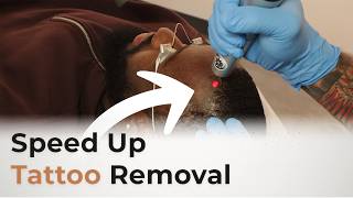 Lymphatic Drainage to Speed Up Laser Tattoo Removal
