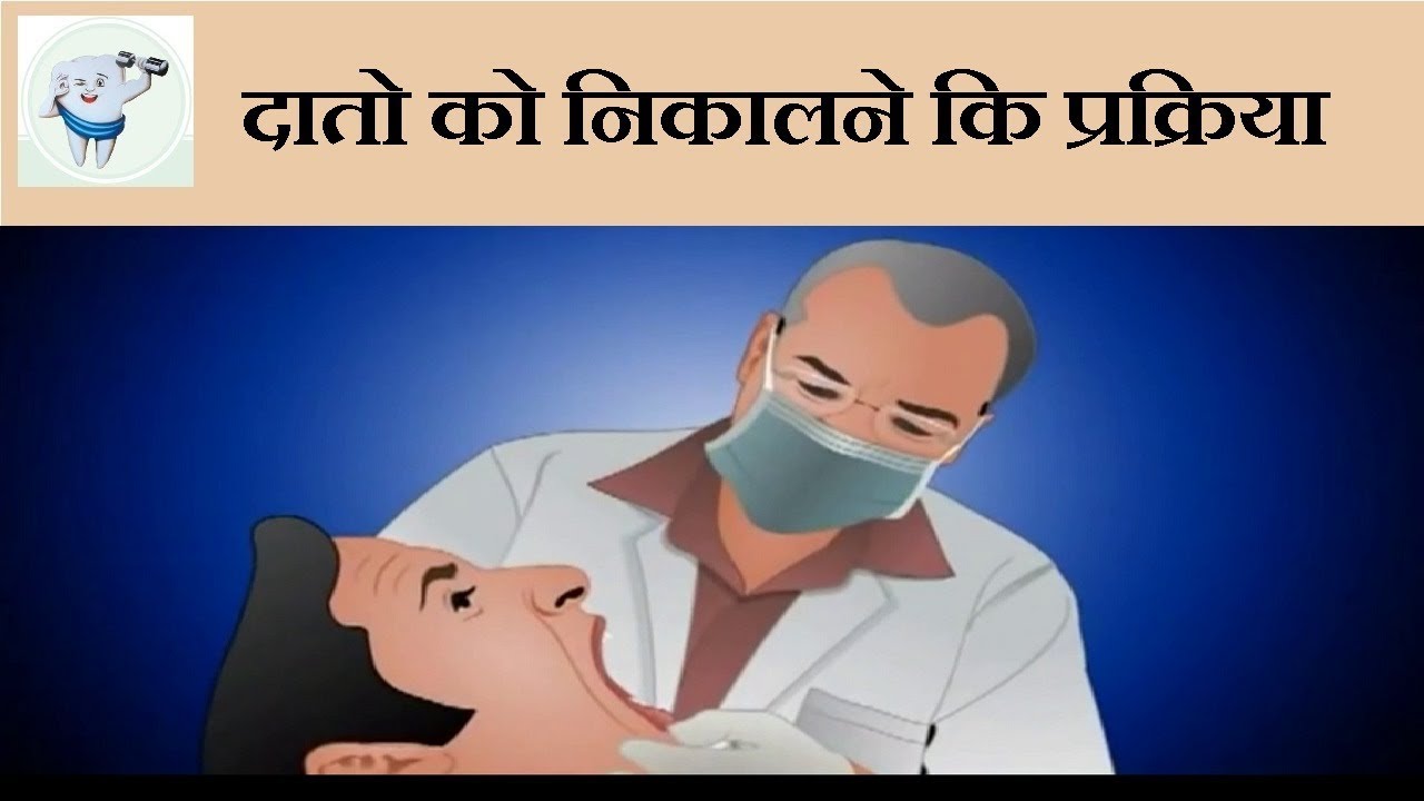 दांत निकालना Tooth Extraction Hindi YouTube