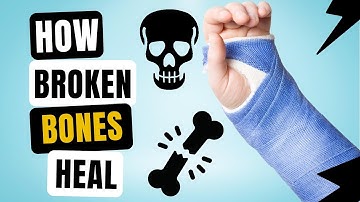 Why Do Bones Break & How Do Broken Bones Heal Themselves?