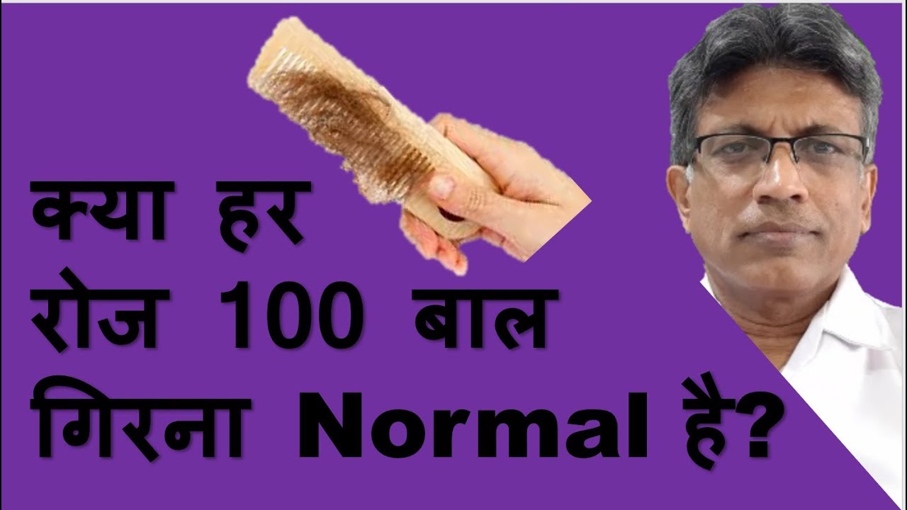  100 Normal Is It Normal To Have Hair Fall