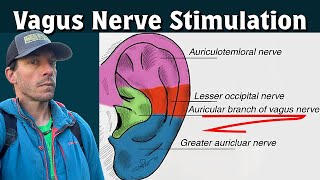 Electrical Vagus Nerve Stimulation To Improve Pelvic Health Part 2