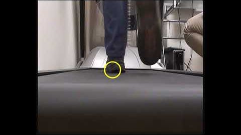 Video gait assessment walking patterns shoe wear lateral instability outside foot pain