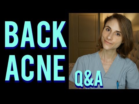 Video: Back Acne: How To Treat It