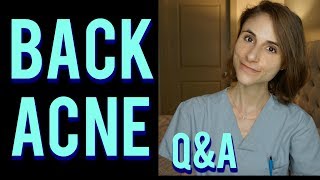 Back acne Q&A with a dermatologist: skin care tips