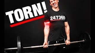 Avoid This Deadlift Mistake (NO TORN BICEPS!)