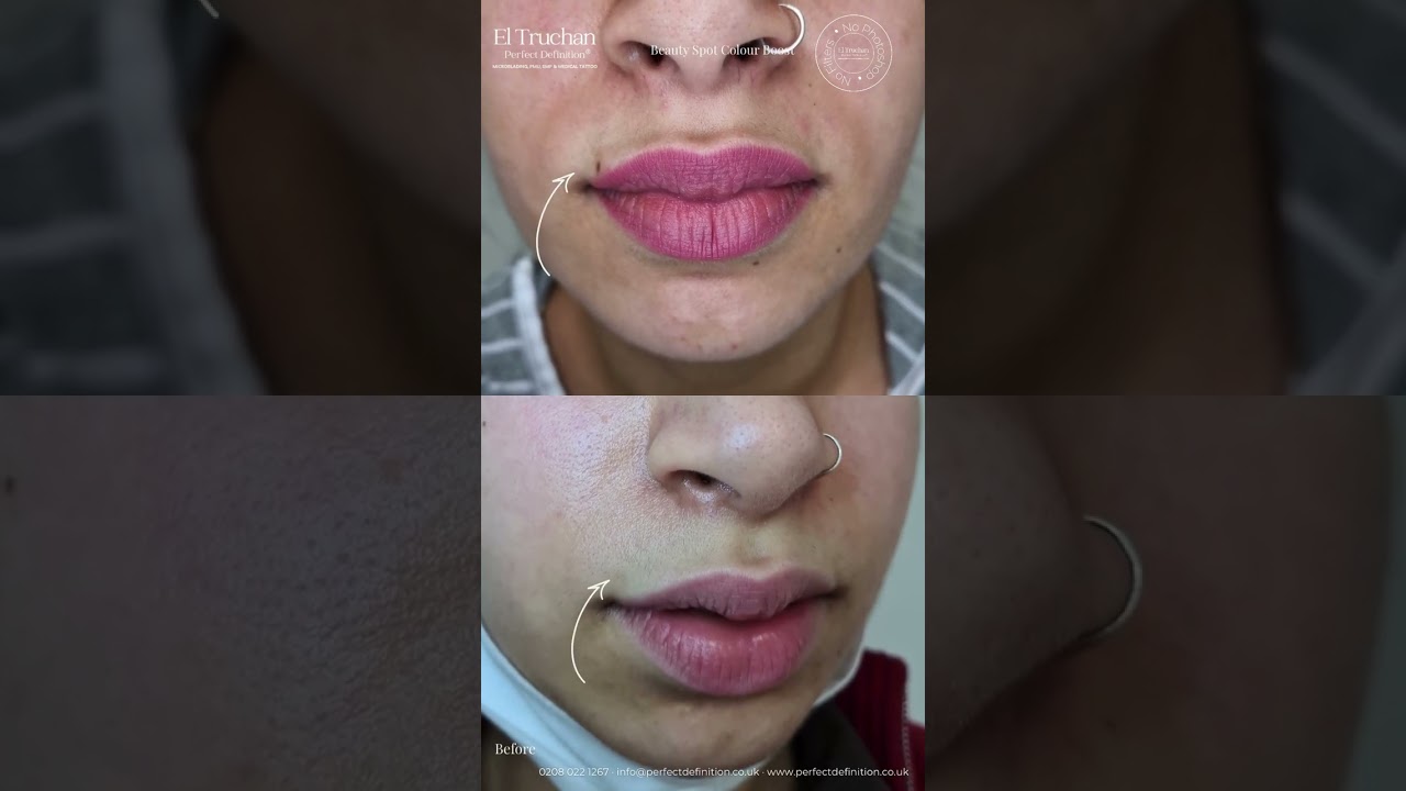 Tattooed beauty spots