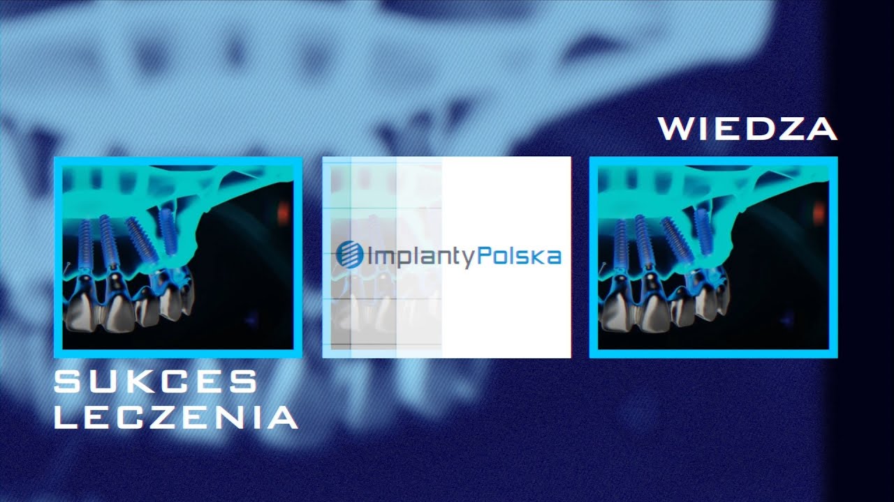 Implanty AXIOM nie tylko na start
