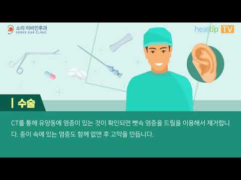 만성 중이염 치료법 ‘유양동 삭개술 및 고실 성형술’ 181214