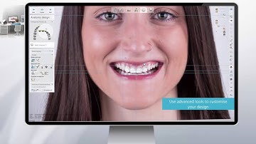 3Shape RealView™ Engine - Next Generation 3D Digital Smile Design
