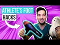 How to get rid of athletes foot between toes removal and treatment