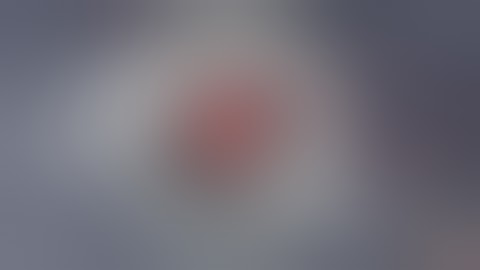 Single Pass Four Throw Pupilloplasty (4TP)