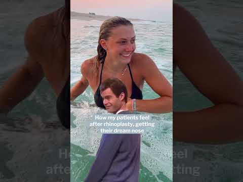 Video thumbnail: nyc new york city new york Rhinoplasty: Enhancing Confidence, Function, and Quality of Life · Robert Morin MD