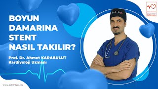 Boyun Damarına Stent (Karotis Stent) Nasıl Takılır? - Prof. Dr. Ahmet Karabulut